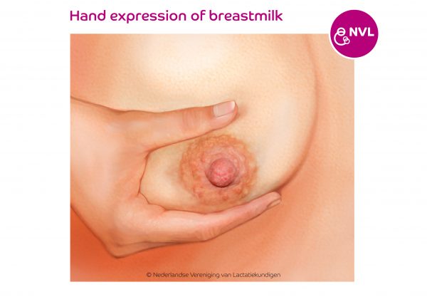 hand expression of breastmilk | NVL