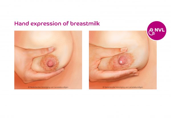 Hand expression of breastmilk | NVL