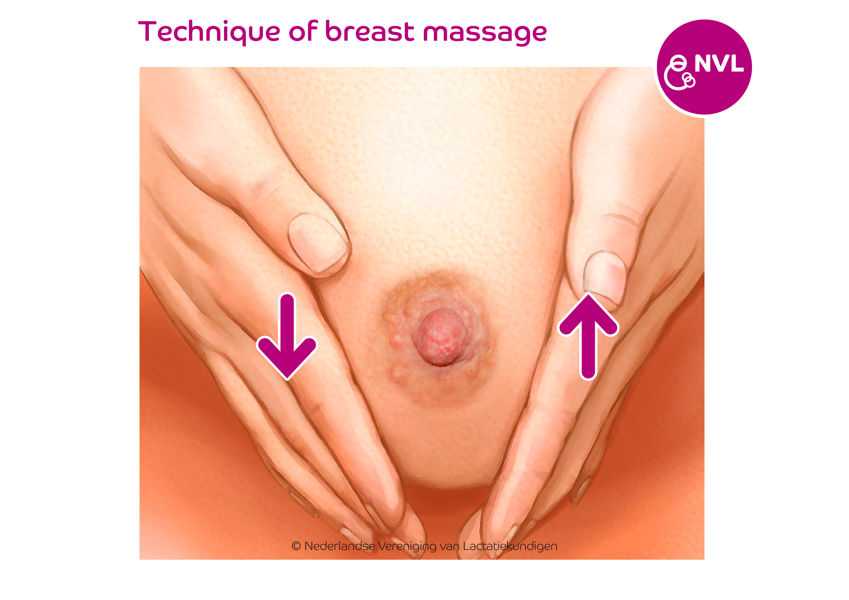 Breastmassage step 2 | NVL