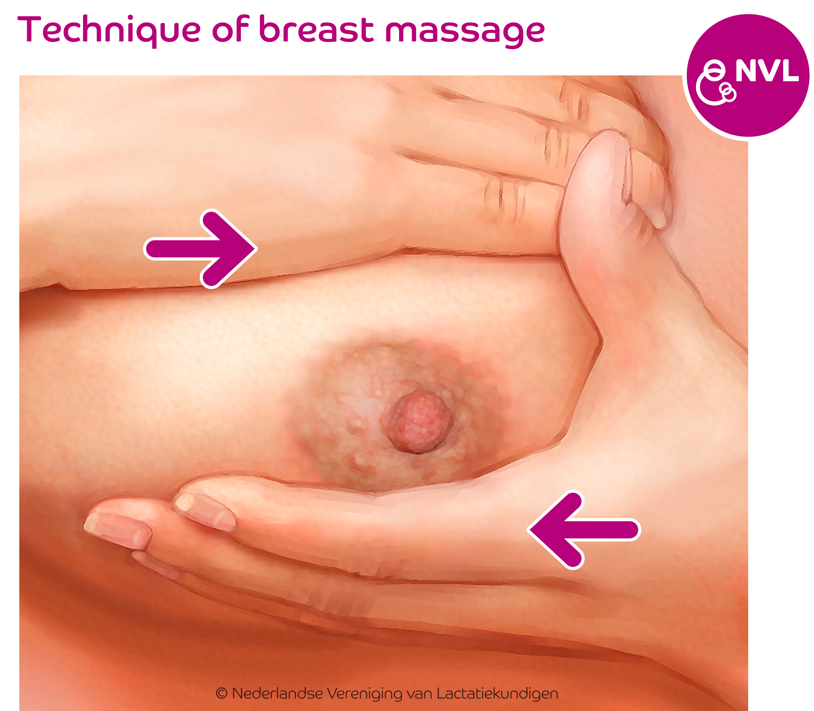Breastmassage step 4 | NVL