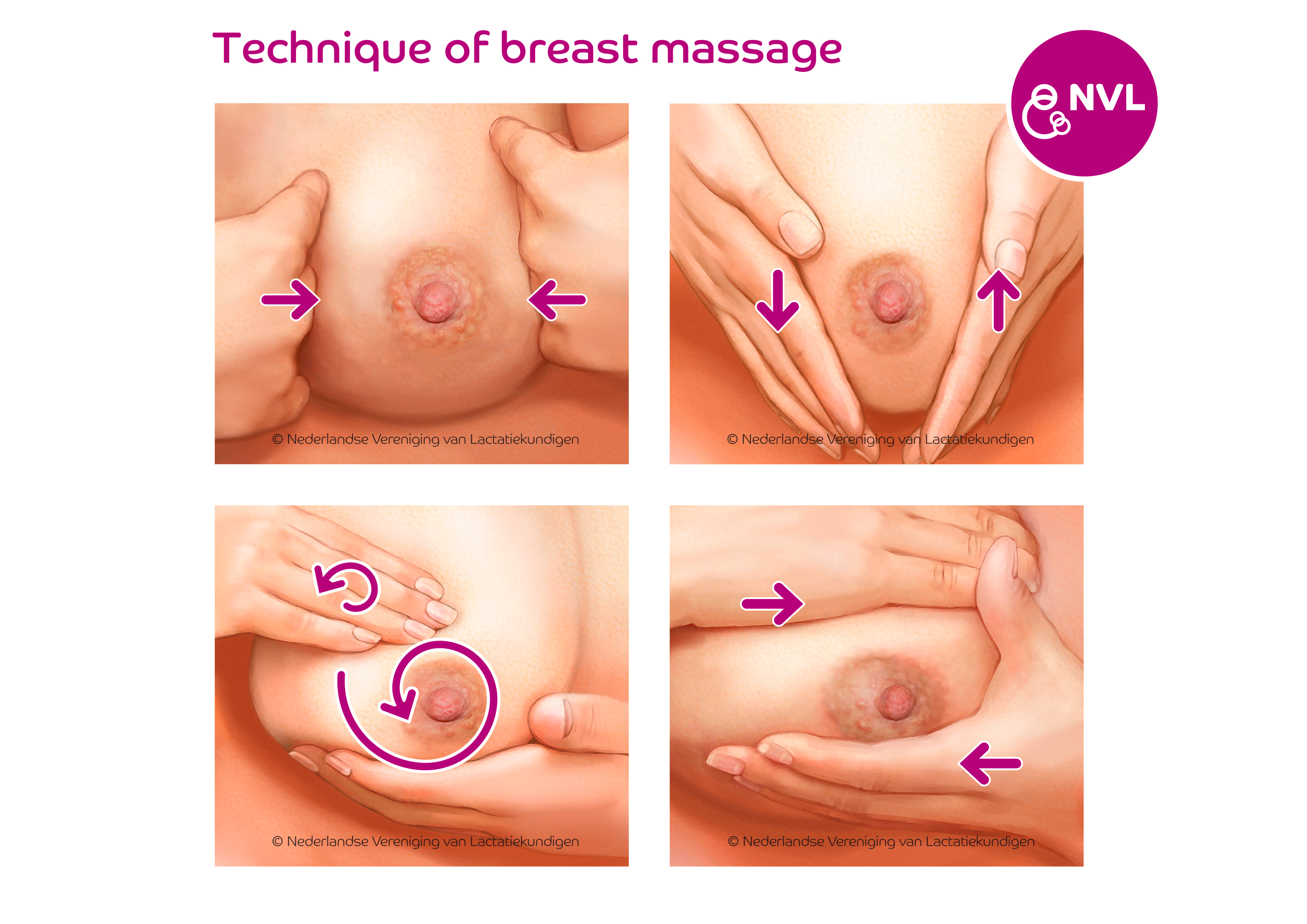 Technique of breast massage | NVL